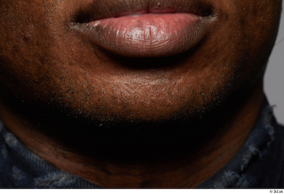 HD Face Skin Clayton Bradford chin face lips mouth skin…